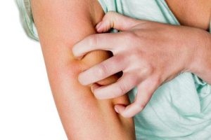 Bei Neurodermitis kann ein Luftbefeuchter Linderung verschaffen. Bild: FOTOLIA/Gina Sanders